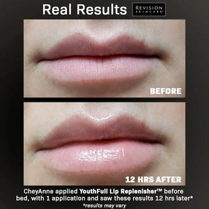 YouthFull Lip Replenisher